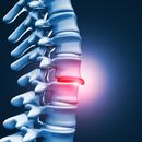 Herniated disc in dogs
