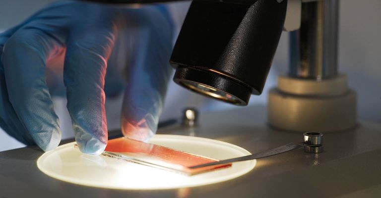 Medizinische Wissenschaftlerin untersucht Blutprobe unter dem Mikroskop, biochemische Forschung
