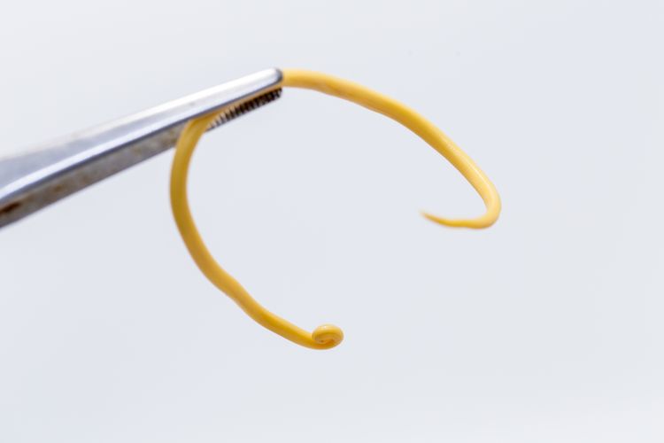 Ascariasis ist eine Krankheit, die durch den parasitären Spulwurm Ascaris lumbricoides für den Unterricht in Laboren verursacht wird. Ascariasis ist eine Krankheit, die durch den parasitären Spulwurm Ascaris lumbricoides für den Unterricht in Laboren verursacht wird.